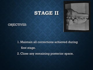 STAGE IISTAGE II
OBJECTIVES:OBJECTIVES:
1. Maintain all corrections achieved during1. Maintain all corrections achieved during
first stage.first stage.
2. Close any remaining posterior space.2. Close any remaining posterior space.
 