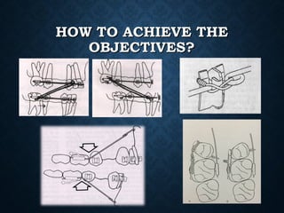 HOW TO ACHIEVE THEHOW TO ACHIEVE THE
OBJECTIVES?OBJECTIVES?
 
