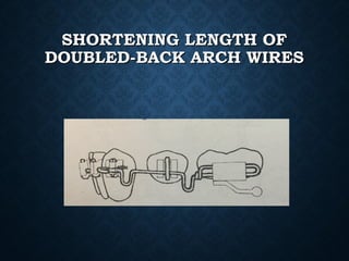 SHORTENING LENGTH OFSHORTENING LENGTH OF
DOUBLED-BACK ARCH WIRESDOUBLED-BACK ARCH WIRES
 