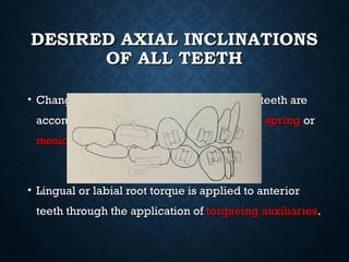 DESIRED AXIAL INCLINATIONSDESIRED AXIAL INCLINATIONS
OF ALL TEETHOF ALL TEETH
• Changes in the mesiodistal inclinations of teeth areChanges in the mesiodistal inclinations of teeth are
accomplished by the use of individualaccomplished by the use of individual root springroot spring oror
mesiodistal uprighting springmesiodistal uprighting spring..
• Lingual or labial root torque is applied to anteriorLingual or labial root torque is applied to anterior
teeth through the application ofteeth through the application of torqueing auxiliariestorqueing auxiliaries..
 