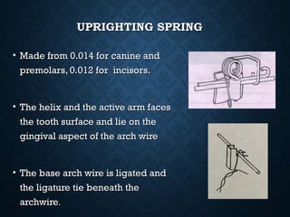 UPRIGHTING SPRINGUPRIGHTING SPRING
• Made from 0.014 for canine andMade from 0.014 for canine and
premolars, 0.012 for incisors.premolars, 0.012 for incisors.
• The helix and the active arm facesThe helix and the active arm faces
the tooth surface and lie on thethe tooth surface and lie on the
gingival aspect of the arch wiregingival aspect of the arch wire
• The base arch wire is ligated andThe base arch wire is ligated and
the ligature tie beneath thethe ligature tie beneath the
archwirearchwire..
 