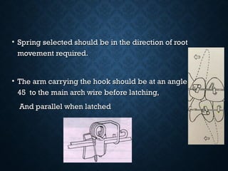 • Spring selected should be in the direction of rootSpring selected should be in the direction of root
movement required.movement required.
• The arm carrying the hook should be at an angle ofThe arm carrying the hook should be at an angle of
45 to the main arch wire before latching,45 to the main arch wire before latching,
And parallel when latchedAnd parallel when latched
 