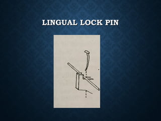 LINGUAL LOCK PINLINGUAL LOCK PIN
 