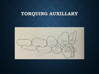 TORQUING AUXILLARYTORQUING AUXILLARY
 