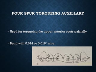 FOUR SPUR TORQUEING AUXILLARYFOUR SPUR TORQUEING AUXILLARY
• Used for torqueing the upper anterior roots palatallyUsed for torqueing the upper anterior roots palatally
• Bend with 0.014 or 0.016” wireBend with 0.014 or 0.016” wire
 
