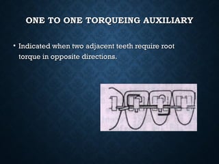 ONE TO ONE TORQUEING AUXILIARYONE TO ONE TORQUEING AUXILIARY
• Indicated when two adjacent teeth require rootIndicated when two adjacent teeth require root
torque in opposite directions.torque in opposite directions.
 