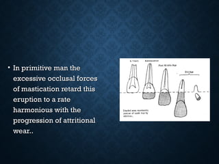 • In primitive man theIn primitive man the
excessive occlusal forcesexcessive occlusal forces
of mastication retard thisof mastication retard this
eruption to a rateeruption to a rate
harmonious with theharmonious with the
progression of attritionalprogression of attritional
wear..wear..
 