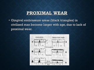 PROXIMAL WEARPROXIMAL WEAR
• Gingival embrassure areas (black triangles) inGingival embrassure areas (black triangles) in
civilized man become larger with age, due to lack ofcivilized man become larger with age, due to lack of
proximal wear.proximal wear.
 
