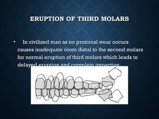 ERUPTION OF THIRD MOLARSERUPTION OF THIRD MOLARS
• In civilized man as no proximal wear occursIn civilized man as no proximal wear occurs
causes inadequate room distal to the second molarscauses inadequate room distal to the second molars
for normal eruption of third molars which leads tofor normal eruption of third molars which leads to
delayed eruption and complete impaction.delayed eruption and complete impaction.
 