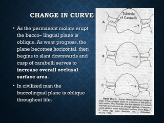 CHANGE IN CURVE OF WILSONCHANGE IN CURVE OF WILSON
• As the permanent molars eruptAs the permanent molars erupt
the bucco– lingual plane isthe bucco– lingual plane is
oblique. As wear progress, theoblique. As wear progress, the
plane becomes horizontal, thenplane becomes horizontal, then
begins to slant downwards andbegins to slant downwards and
cusp of carabelli serves tocusp of carabelli serves to
increase overall occlusalincrease overall occlusal
surface areasurface area..
• In civilized man theIn civilized man the
buccolingual plane is obliquebuccolingual plane is oblique
throughout life.throughout life.
 