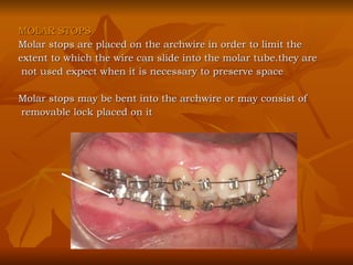 MOLAR STOPS Molar stops are placed on the archwire in order to limit the  extent to which the wire can slide into the molar tube.they are not used expect when it is necessary to preserve space Molar stops may be bent into the archwire or may consist of  removable lock placed on it 