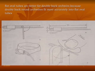 flat oval tubes are better for double back archwire,because  double back round archwires fit more accurately into flat oval  tubes  