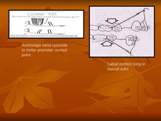 Anchorage bend opposite to molar premolar contact point Labial portion lying in buccal sulci 