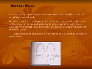 Bayonet bends : Commonly used passively to retain overrotation brought about via previously looped arch. It is inadvisable to use bayonet bends for active correction, because of the tendency for round archwire to rotate within bracket slots causing the bayonet bend to become ineffective or supply movement in wrong plane They should be small and offset section is 5 degrees to the line of main arch. 