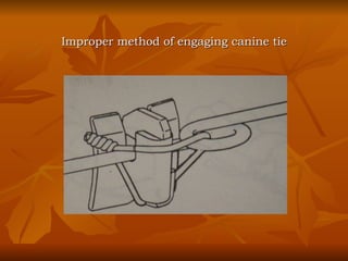 Improper method of engaging canine tie 