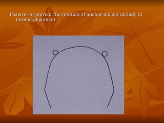 Passive- to prevent the rotation of anchor molars already in  normal alignment 