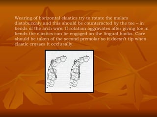 Wearing of horizontal elastics try to rotate the molars distobuccaly and this should be counteracted by the toe – in bends of the arch wire. If rotation aggravates after giving toe in bends the elastics can be engaged on the lingual hooks. Care should be taken of the second premolar so it doesn’t tip when elastic crosses it occlusally. 
