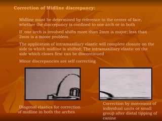 Correction of Midline discrepancy: Midline must be determined by reference to the center of face, whether the discrepancy is confined to one arch or in both If  one arch is involved shifts more than 2mm is major; less than 2mm is a minor problem. The application of intramaxillary elastic will complete closure on the side to which midline is shifted; The intramaxillary elastic on the side which closes first can be discontinued Minor discrepancies are self correcting Diagonal elastics for correction of midline in both the arches Correction by movement of individual units or small group after distal tipping of canine 