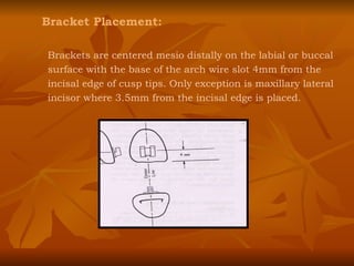 Bracket Placement: Brackets are centered mesio distally on the labial or buccal surface with the base of the arch wire slot 4mm from the incisal edge of cusp tips. Only exception is maxillary lateral incisor where 3.5mm from the incisal edge is placed. 
