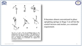 Sunday, November 26, 2023 100
It becomes almost conventional to place
uprighting springs in Stage 3 on all but the
central incisors and molars, as a minimal
requirement.
 