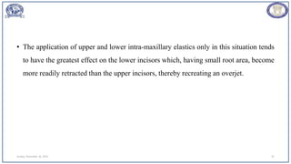 • The application of upper and lower intra-maxillary elastics only in this situation tends
to have the greatest effect on the lower incisors which, having small root area, become
more readily retracted than the upper incisors, thereby recreating an overjet.
Sunday, November 26, 2023 32
 