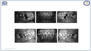 Sunday, November 26, 2023 35
 