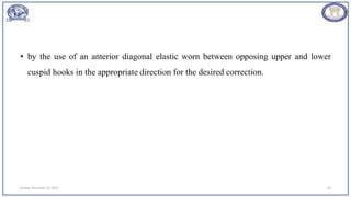 • by the use of an anterior diagonal elastic worn between opposing upper and lower
cuspid hooks in the appropriate direction for the desired correction.
Sunday, November 26, 2023 49
 