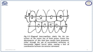 Sunday, November 26, 2023 50
 