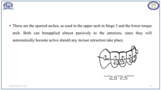 • These are the spurred arches, as used in the upper arch in Stage 3 and the lower torque
arch. Both can benapplied almost passively to the anteriors, since they will
automatically become active should any incisor retraction take place.
Sunday, November 26, 2023 63
 