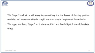 • The Stage 3 archwires will carry inter-maxillary traction hooks of the ring pattern,
mesial to and in contact with the cuspid brackets, bent in the plane of the archwire.
• The upper and lower Stage 3 arch wires are fitted and firmly ligated into all brackets,
using
Sunday, November 26, 2023 83
 