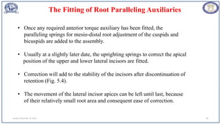 Sunday, November 26, 2023 89
• Once any required anterior torque auxiliary has been fitted, the
paralleling springs for mesio-distal root adjustment of the cuspids and
bicuspids are added to the assembly.
• Usually at a slightly later date, the uprighting springs to correct the apical
position of the upper and lower lateral incisors are fitted.
• Correction will add to the stability of the incisors after discontinuation of
retention (Fig. 5.4).
• The movement of the lateral incisor apices can be left until last, because
of their relatively small root area and consequent ease of correction.
The Fitting of Root Paralleling Auxiliaries
 