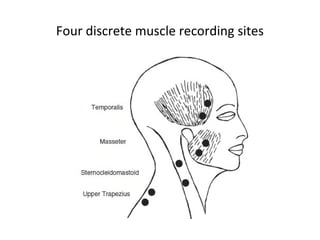 Four discrete muscle recording sites
 