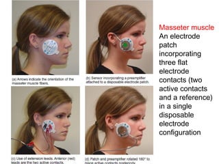Masseter muscle
An electrode
patch
incorporating
three flat
electrode
contacts (two
active contacts
and a reference)
in a single
disposable
electrode
configuration
 