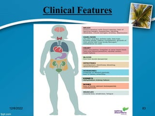 Clinical Features
12/8/2022 83
 