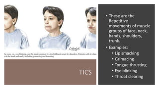 TICS
• These are the
Repetitive
movements of muscle
groups of face, neck,
hands, shoulders,
trunk.
• Examples:
• Lip smacking
• Grimacing
• Tongue thrusting
• Eye blinking
• Throat clearing
 