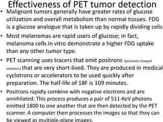 Effectiveness of PET tumor detection
• Malignant tumors generally have greater rates of glucose
utilization and overall metabolism than normal tissues. FDG
is a glucose analogue that is taken up by rapidly dividing cells.
• Most melanomas are rapid users of glucose; in fact,
melanoma cells in vitro demonstrate a higher FDG uptake
than any other tumor type.
• PET scanning uses tracers that emit positrons (positively charged
electrons) that are very short-lived. They are produced in medical
cyclotrons or accelerators to be used quickly after
preparation. The half-life of 18F is 109 minutes.
• Positrons rapidly combine with negative electrons and are
annihilated. This process produces a pair of 511-KeV photons
emitted 1800 to one another that are then detected by the PET
scanner. A computer then processes the images so that they can
 