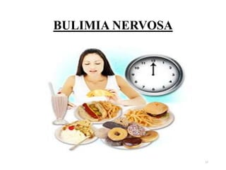 BULIMIA NERVOSA
17
 
