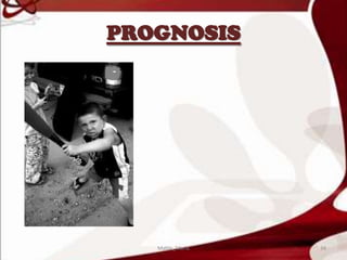 PROGNOSIS
34Mable_Maria
 
