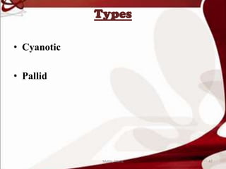 Types
• Cyanotic
• Pallid
47Mable_Maria
 