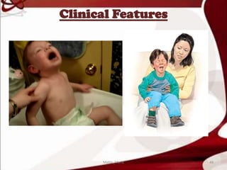 Clinical Features
49Mable_Maria
 