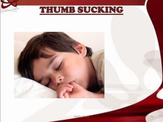 THUMB SUCKING
55Mable_Maria
 