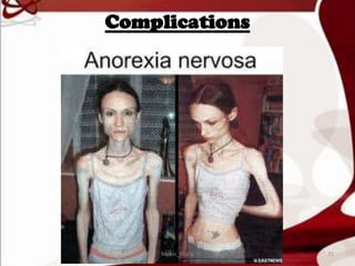 Complications
71Mable_Maria
 