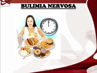 BULIMIA NERVOSA
73Mable_Maria
 