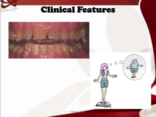 Clinical Features
76Mable_Maria
 