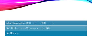 Initial examination : BEH ------ TSD------ +
LA : BEH ------ VC ------ + ( INJ)
LA: BEH + +
 