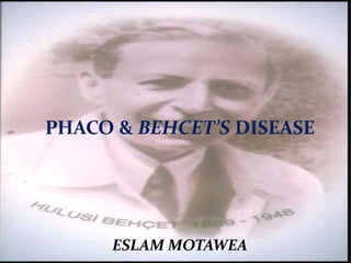 PHACO & BEHCET’S DISEASE
ESLAM MOTAWEA
 