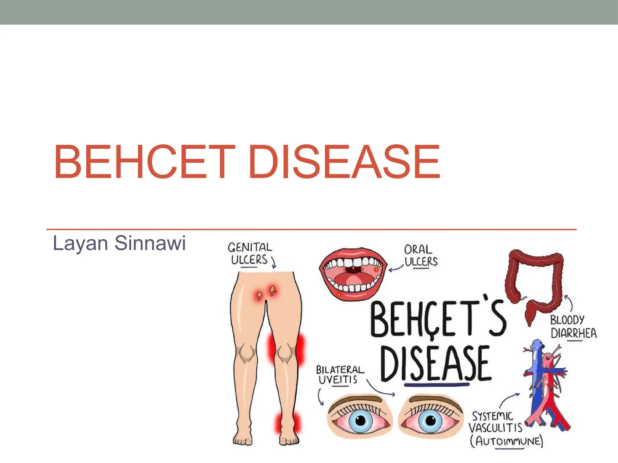 Behcet disease presentation .pptx
