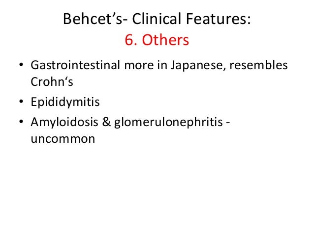 Behcet's Disease