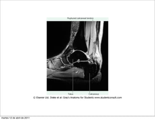 martes 12 de abril de 2011
 