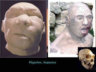Miguelon, Atapuerca
 